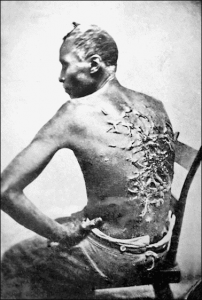 A slave shows his scars from being whipped, Baton Rouge, Louisiana, 1863. (Source: Blakeslee Collection photograph)